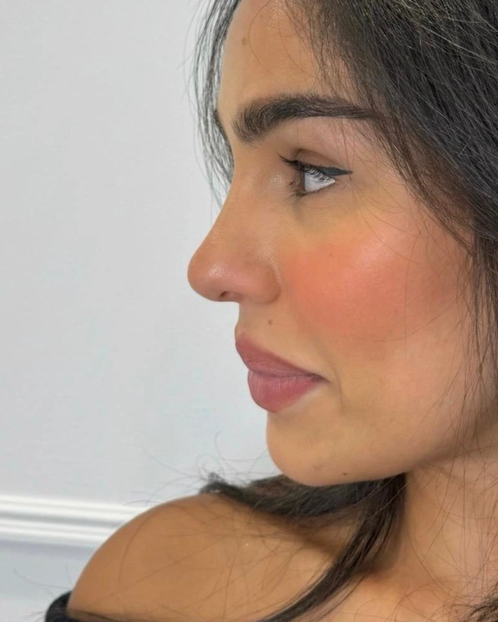 Profile balancing, case 2 of 7: before
