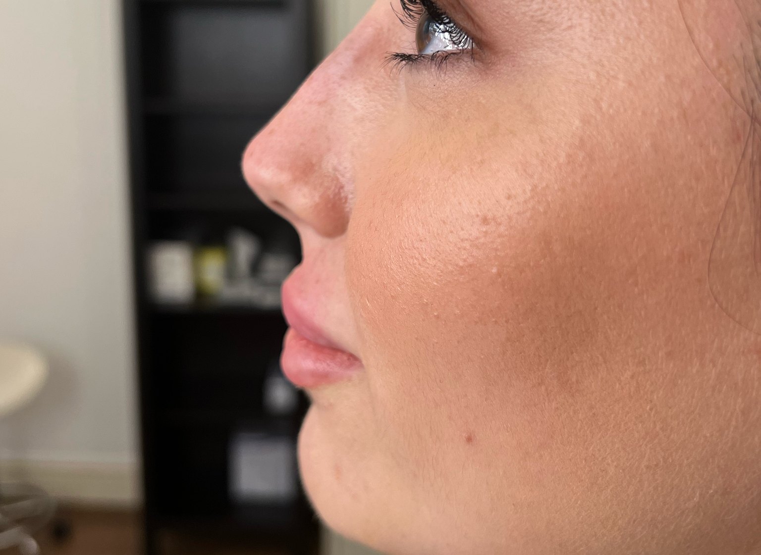 Profile Balancing