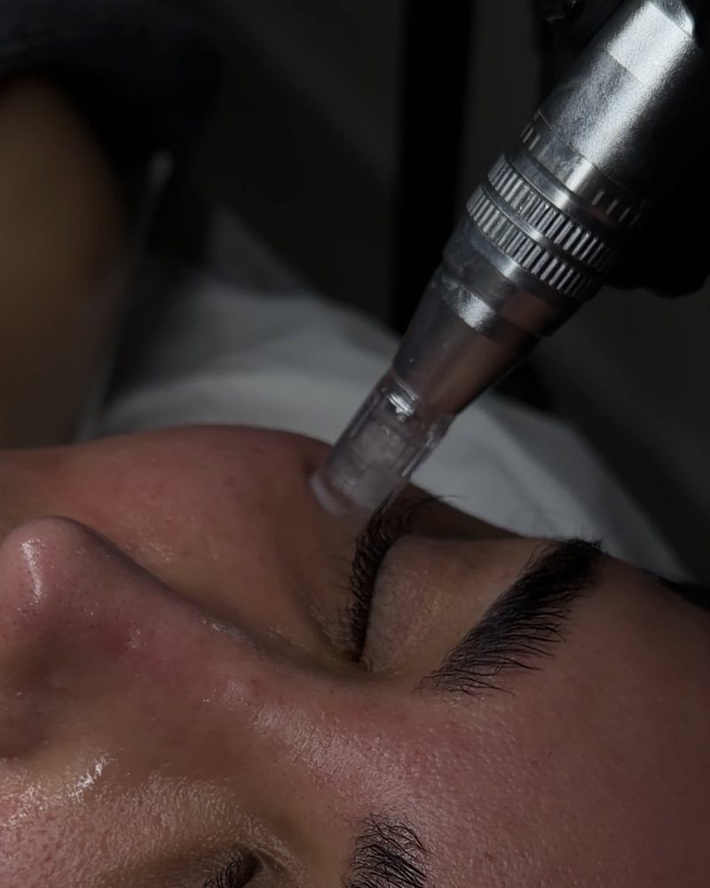 Facial & Skin Treatments at By Narjis