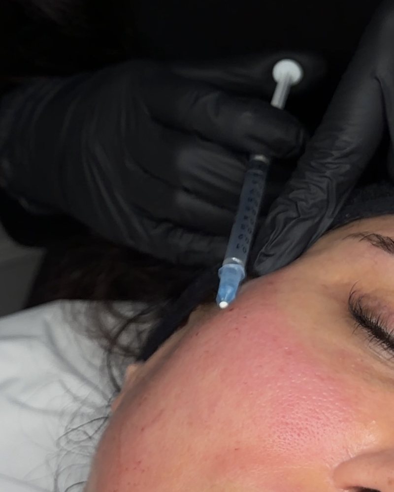 Full Face Skin Booster
