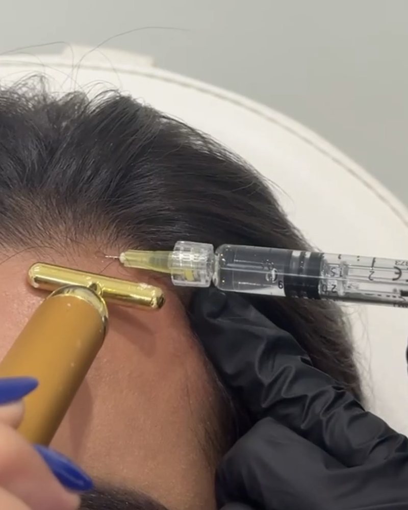 Hair Regeneration Treatments at By Narjis